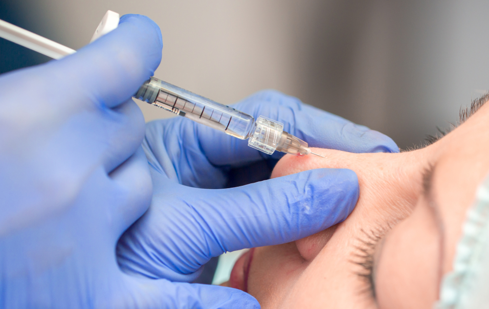 Non-Surgical Rhinoplasty