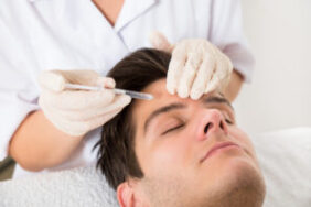 Botox for Men