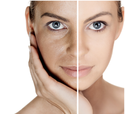 laser treatment cost
