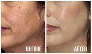 cosmetic treatment cost