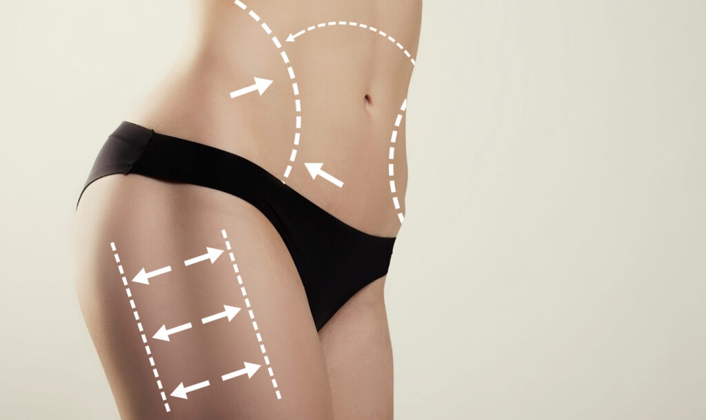 Emsculpt vs CoolSculpting