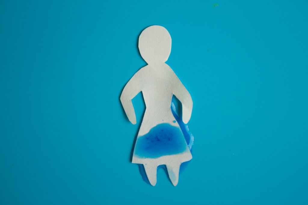 EMSELLA Incontinence Treatment
