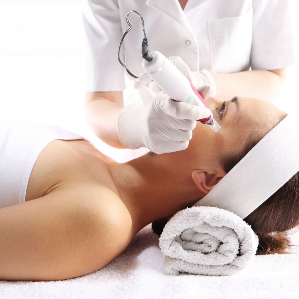 radiofrequency microneedling