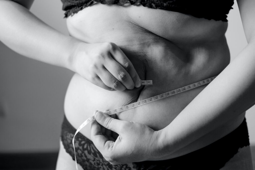 laser liposuction cost