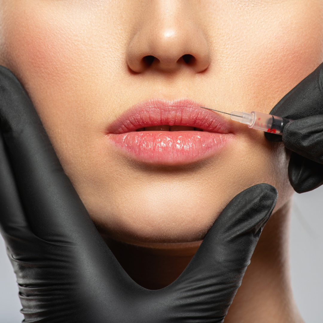 Best Lip Fillers for Small Lips