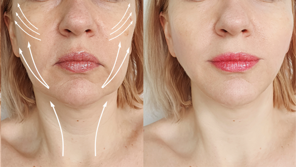 Best Wrinkle Eraser for Your Face