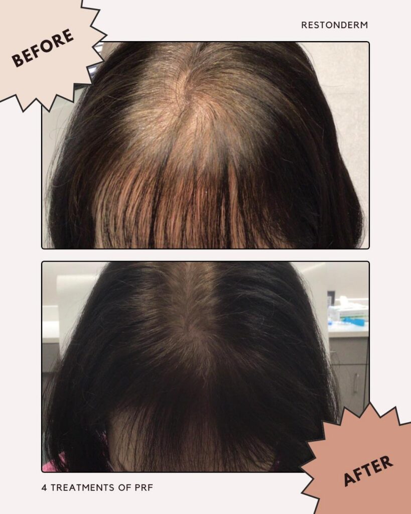 Best Hair Loss Clinic in Virginia