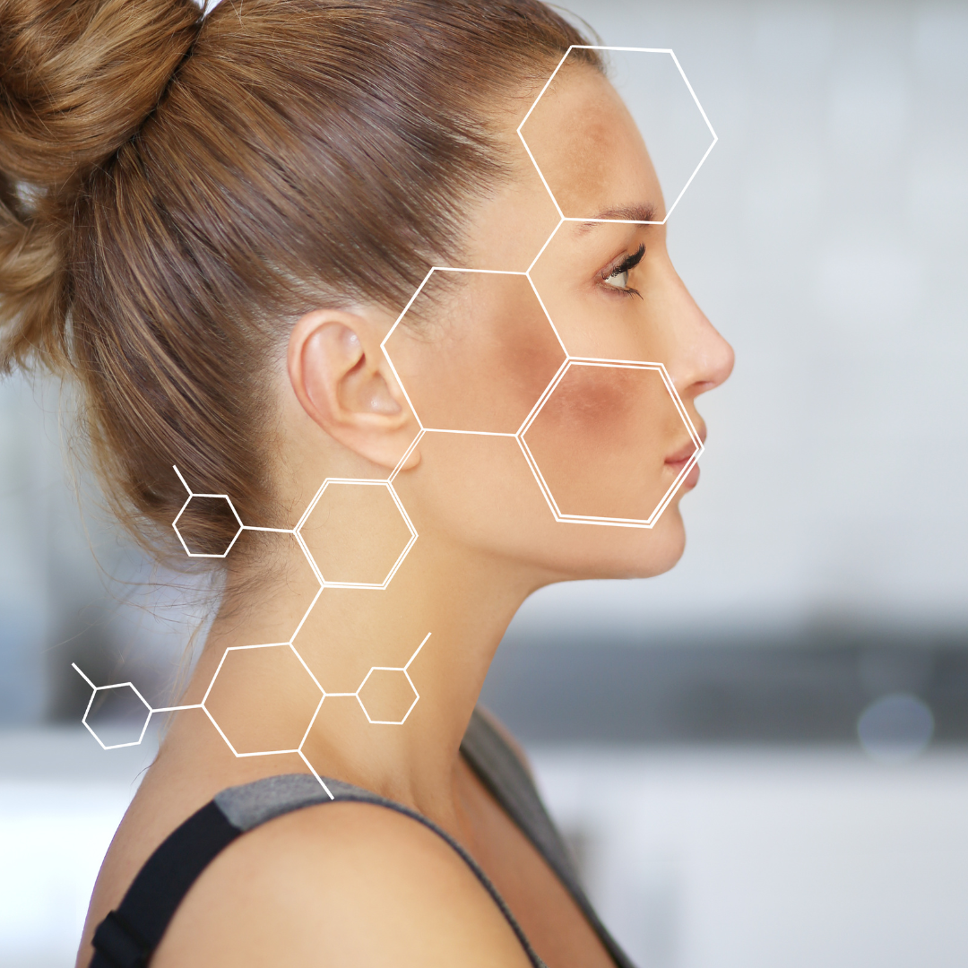 IPL Cost for Dark Spot Reduction Northern Virginia