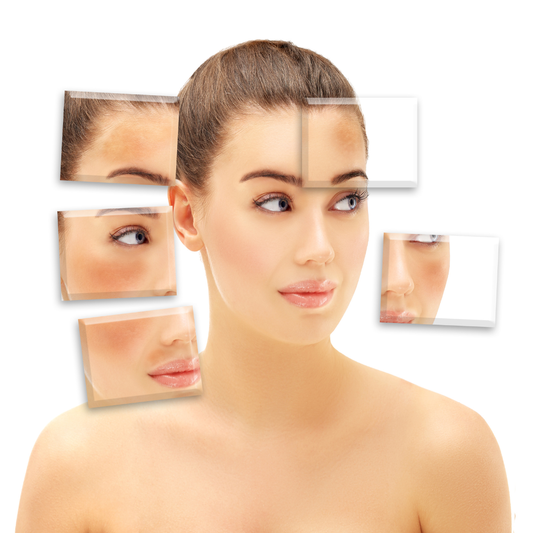 Cost of Laser Treatments for Melasma Northern Virginia