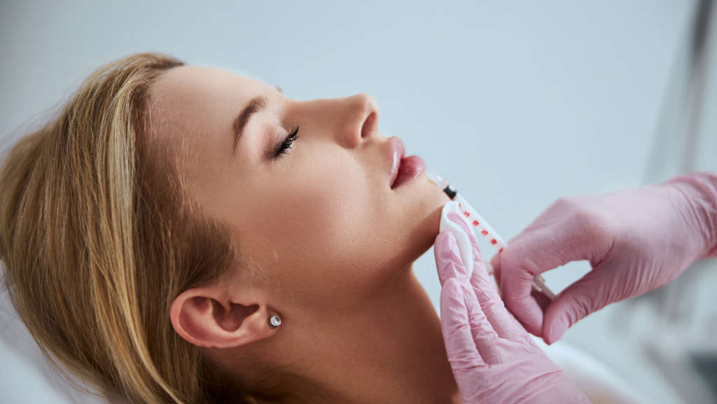 How Long Do Lip Fillers Last?