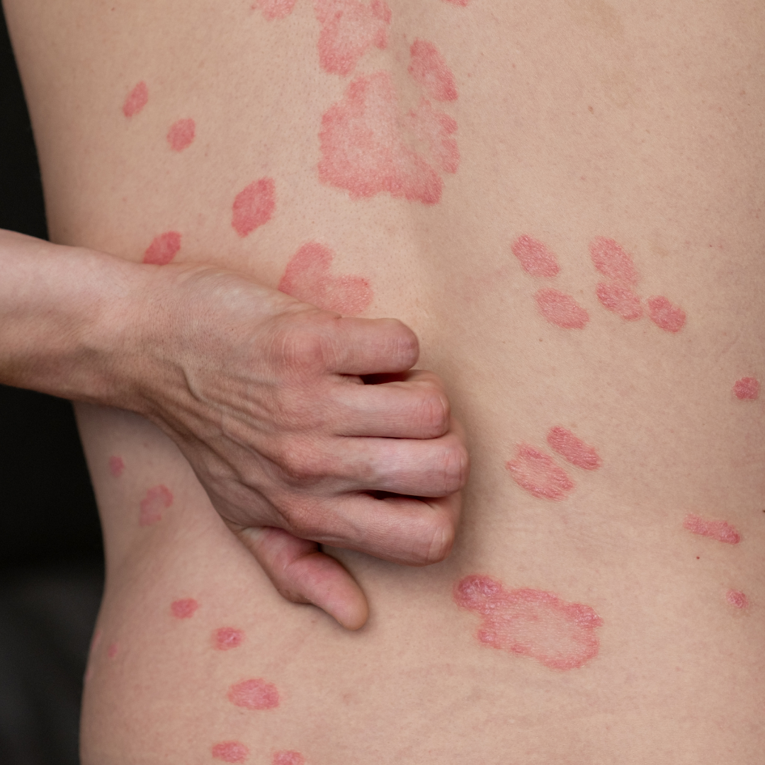 Urgent Care Dermatology Near Ashburn