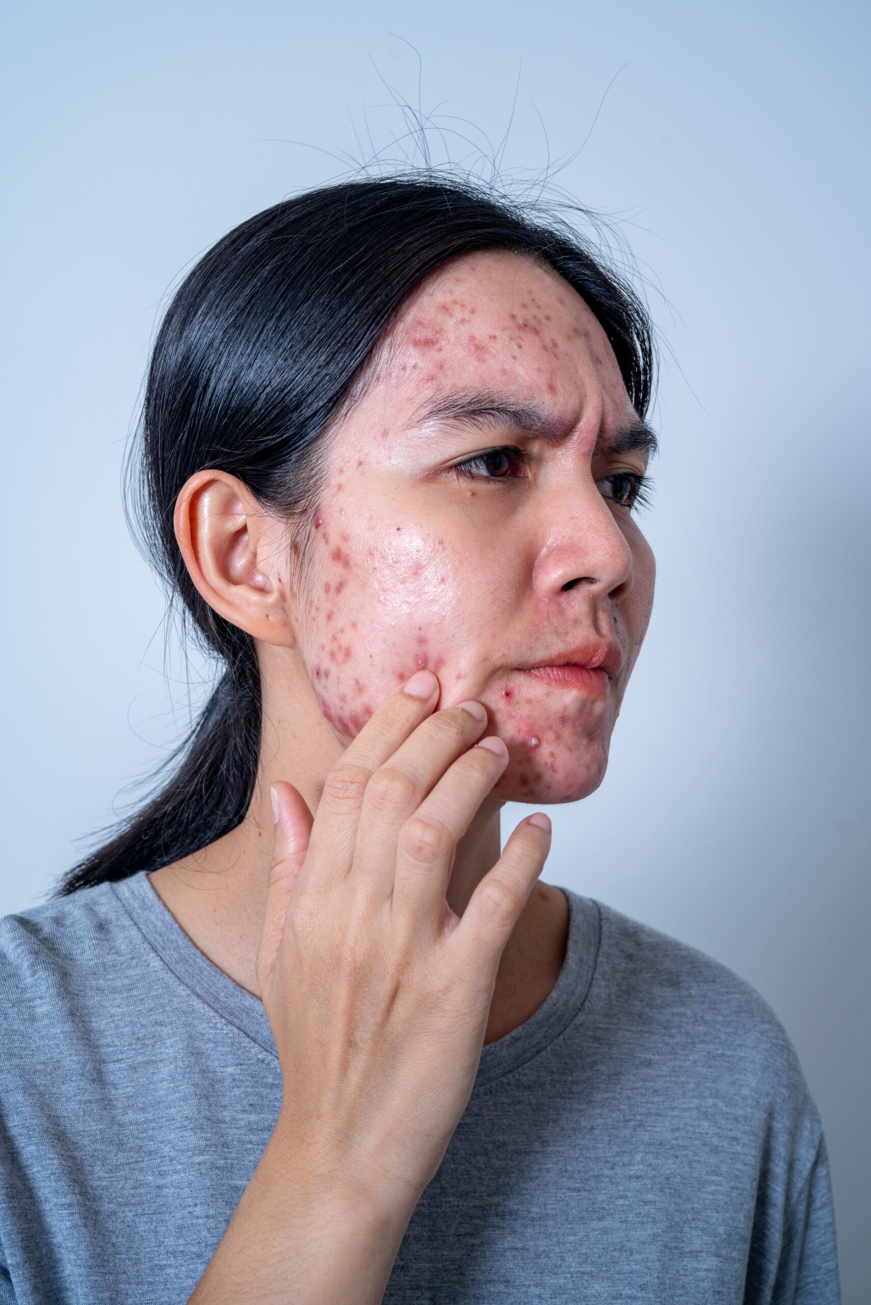 Dermatologist Accepting Aetna Northern Virginia