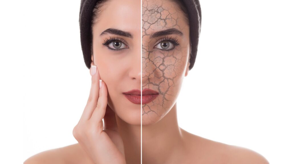 Say Goodbye to Dry Skin This Winter: Expert Tips from a Dermatologist