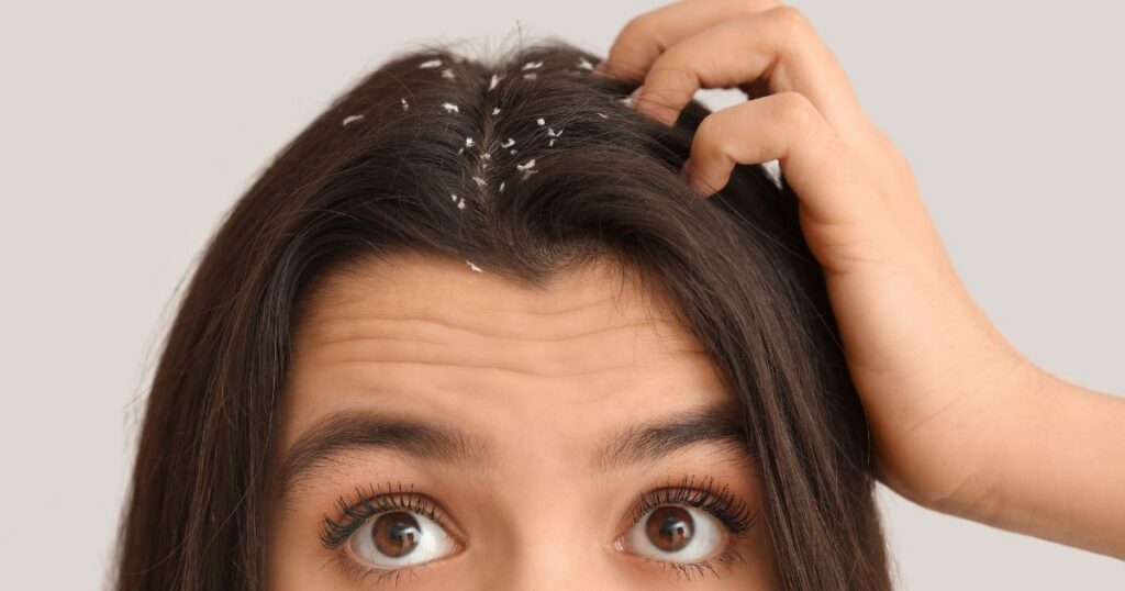 dermatologist for dandruff in Reston